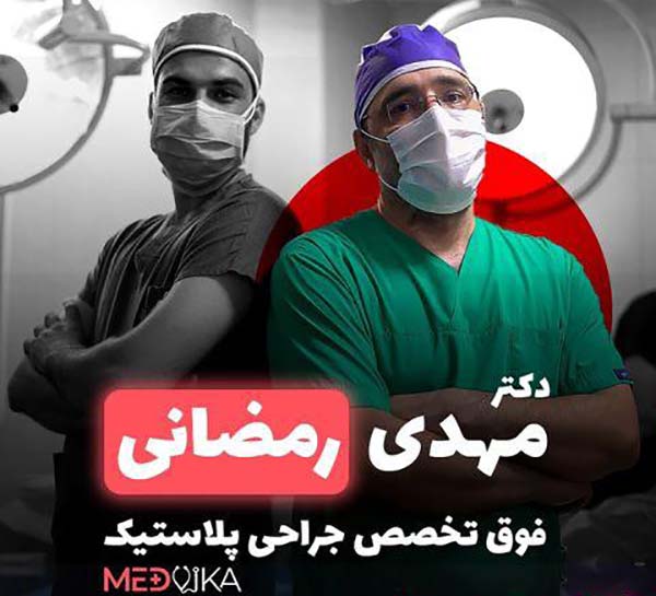 دکتر مهدی رمضانی جراح بینی استخوانی مشهد