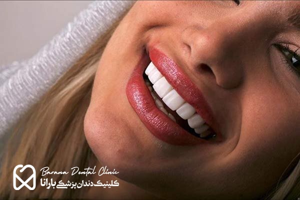 بهترین کامپوزیت دندان در مشهد