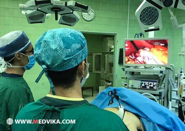 عمل جراحی اسلیو معده در مشهد با لاپاراسکوپی