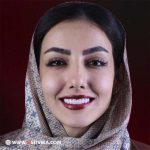 لمینت دندان در مشهد در بهترین دندانپزشکی زیبایی مشهد