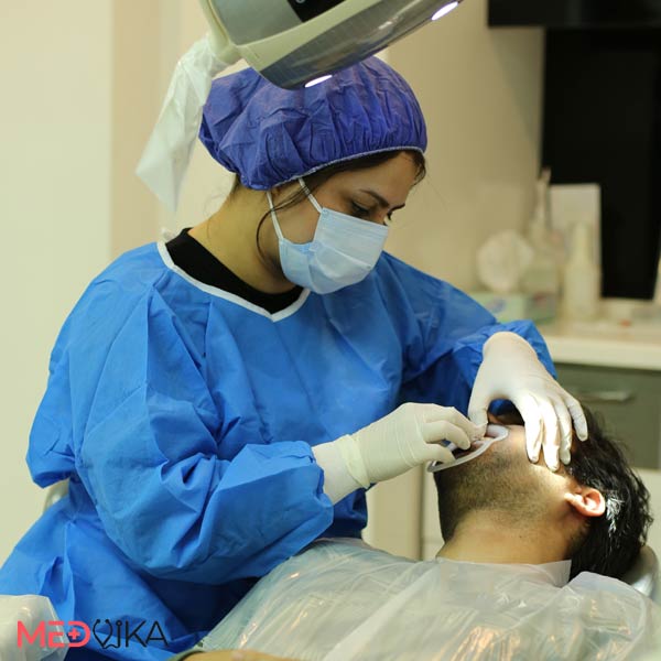 تلميع الاسنان في عيادة اسنان بارانا في ايران مشهد