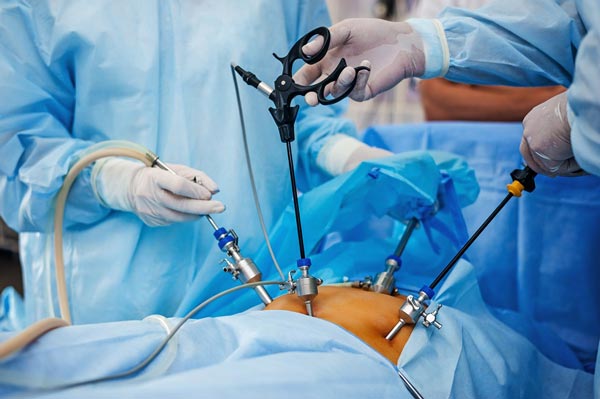 عوارض عمل جراحی معده برای لاغری - عوارض عمل جراحی لاغری