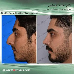 جراحات التجميل في ايران