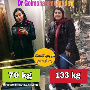 Before After Photo of Gastric Bypass Surgery by Dr Golmohammadzadeh