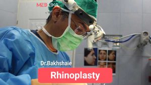 Rhinoplasty by Dr.Bakhshaie