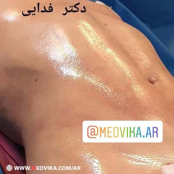 تجارب نحت الجسم في ايران طهران