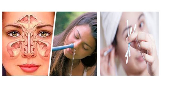 The Right Way Of Washing A Nose After Rhinoplasty