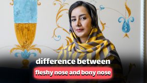 difference between fleshy nose and bony nose