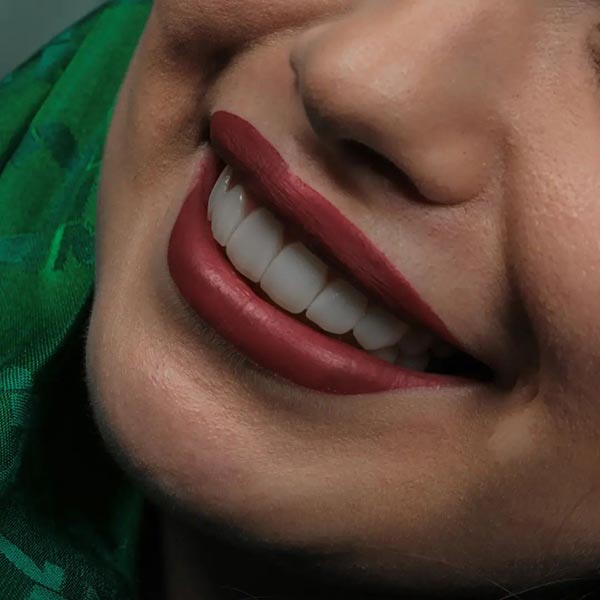 بعد ابتسامة هوليود في ايران