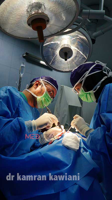 دکتر کاویانی بهترین جراح پیکرتراشی در مشهد