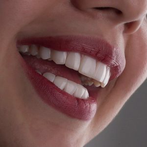 معرفی بهترین دندانپزشکی در مشهد