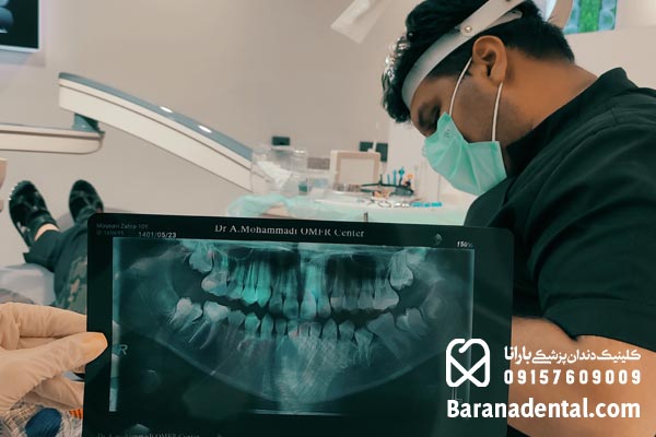 عصب کشی دندان در مشهد 