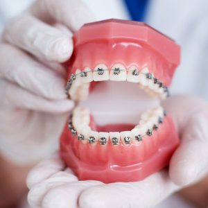 بهترین مرکز ارتودنسی دندان مشهد