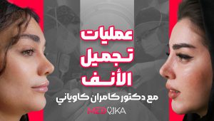 عمليات تجميل الانف مع دكتور كاوياني في مشهد