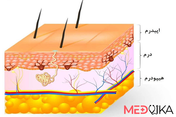 میزان نفوذ مواد مزوتراپی صورت در درم و اپیدرم پوست